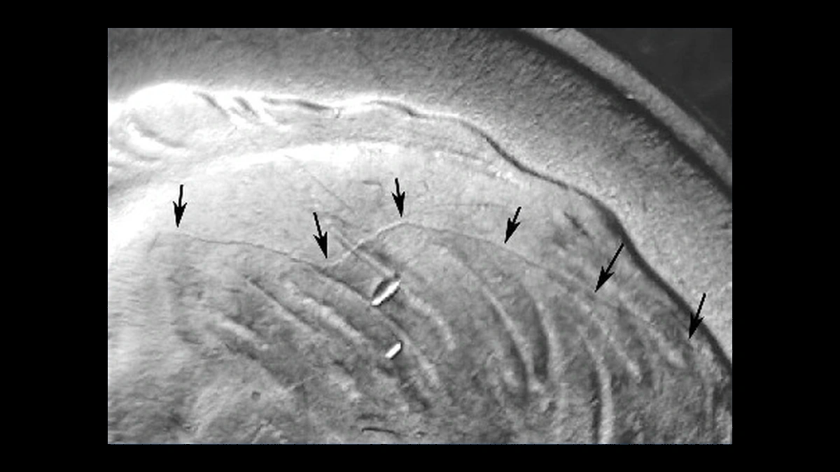 1948 Roosevelt Dime: Die Cracks